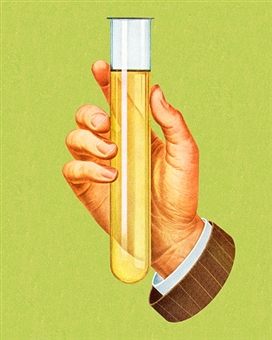 Analisi delle urine: per VISITA SPORTIVA, PER GRAVIDANZA, URINOCOLTURA